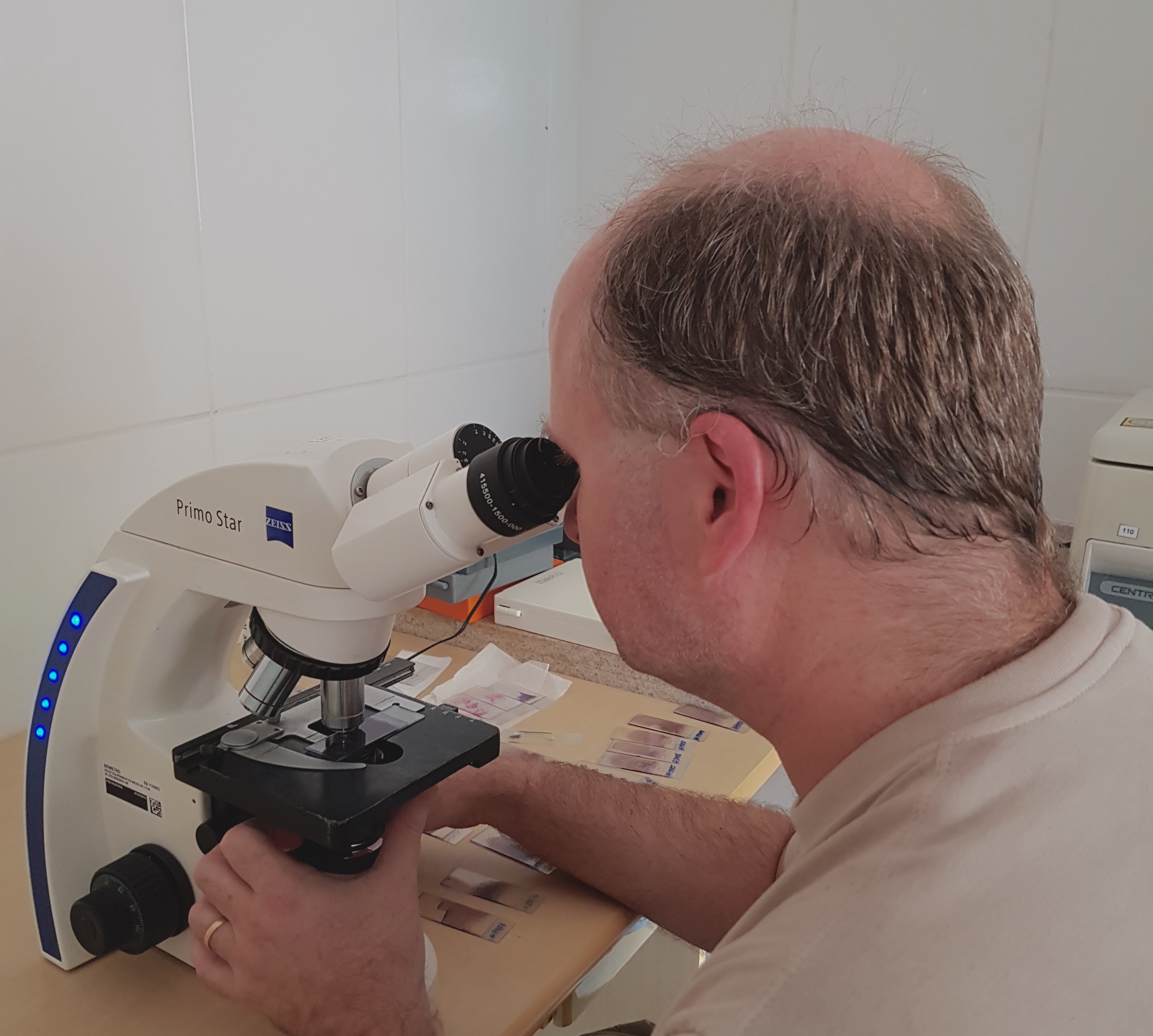 Um homem de meia-idade com cabelos ralos está olhando através de um microscópio em um ambiente de laboratório. Ele está concentrado na observação, e há lâminas de amostras e outros equipamentos de laboratório sobre a mesa ao seu redor.